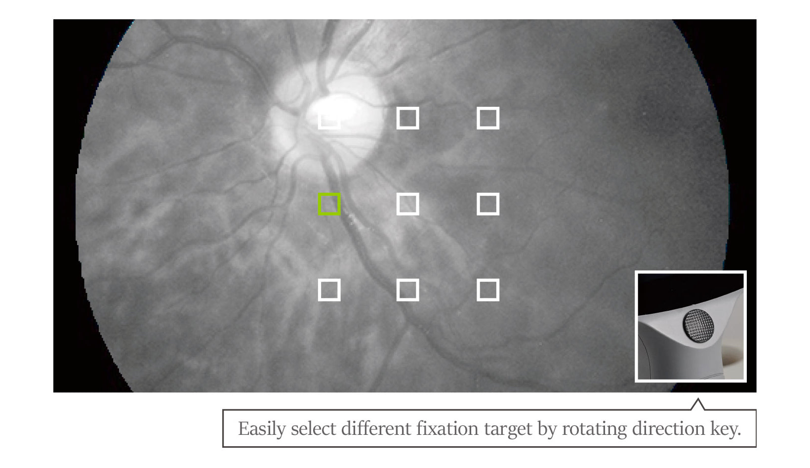 fundus camera efc-1800