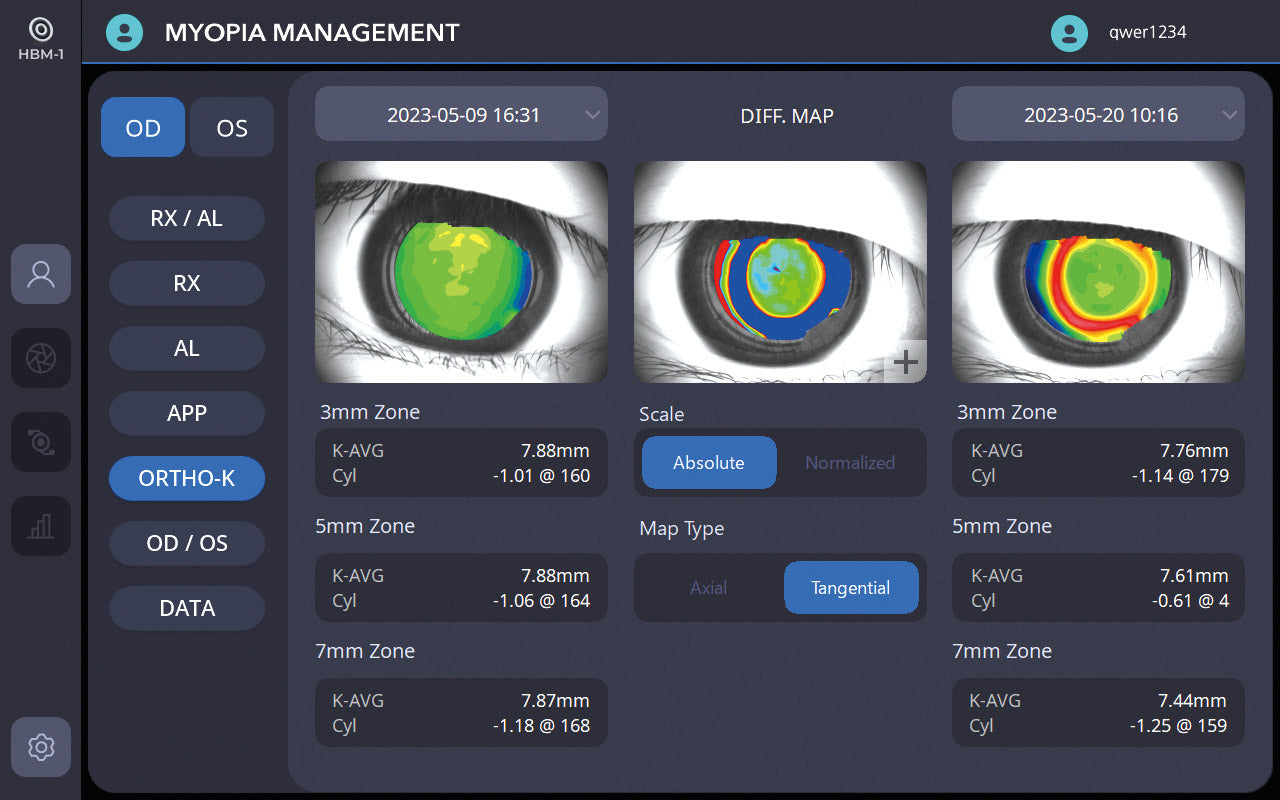 biometer hbm-1