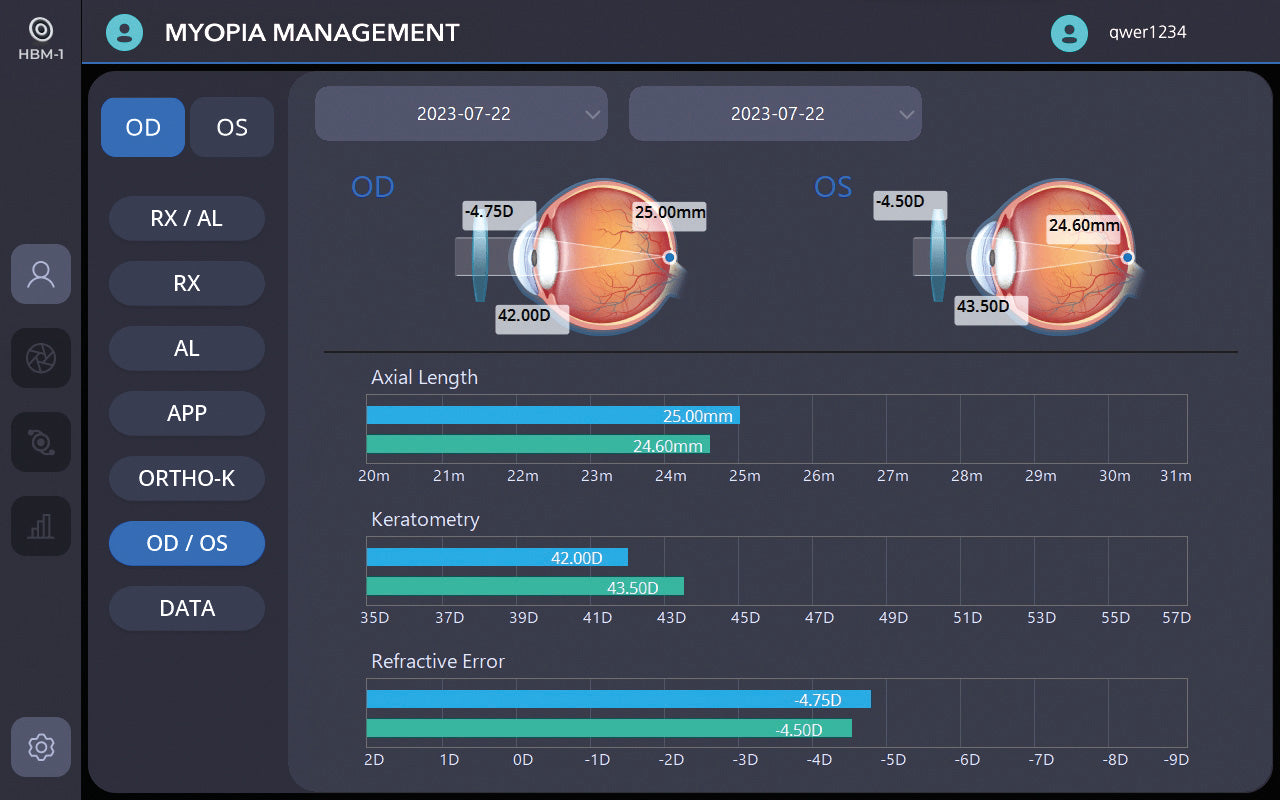 biometer hbm-1