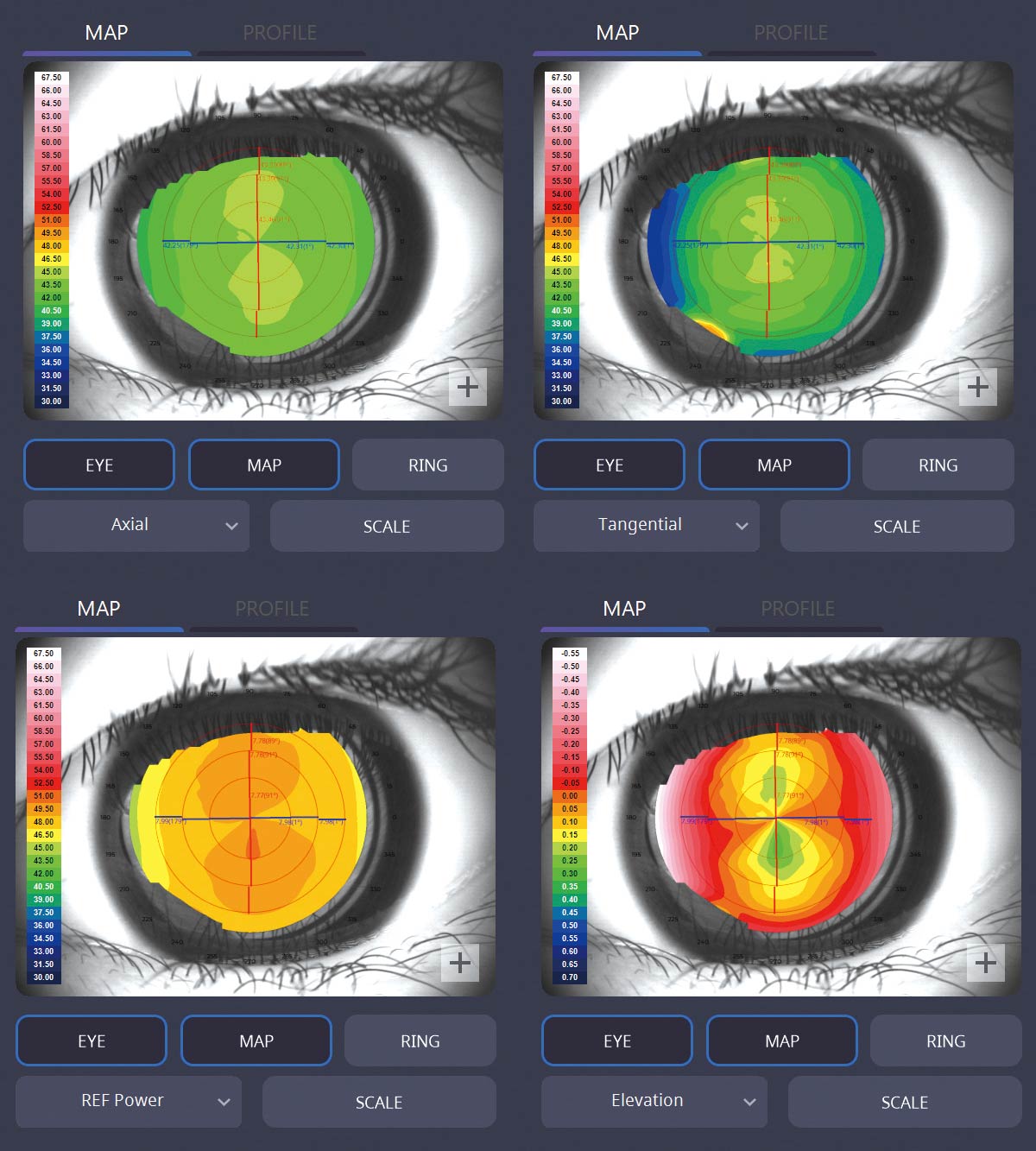 biometer hbm-1