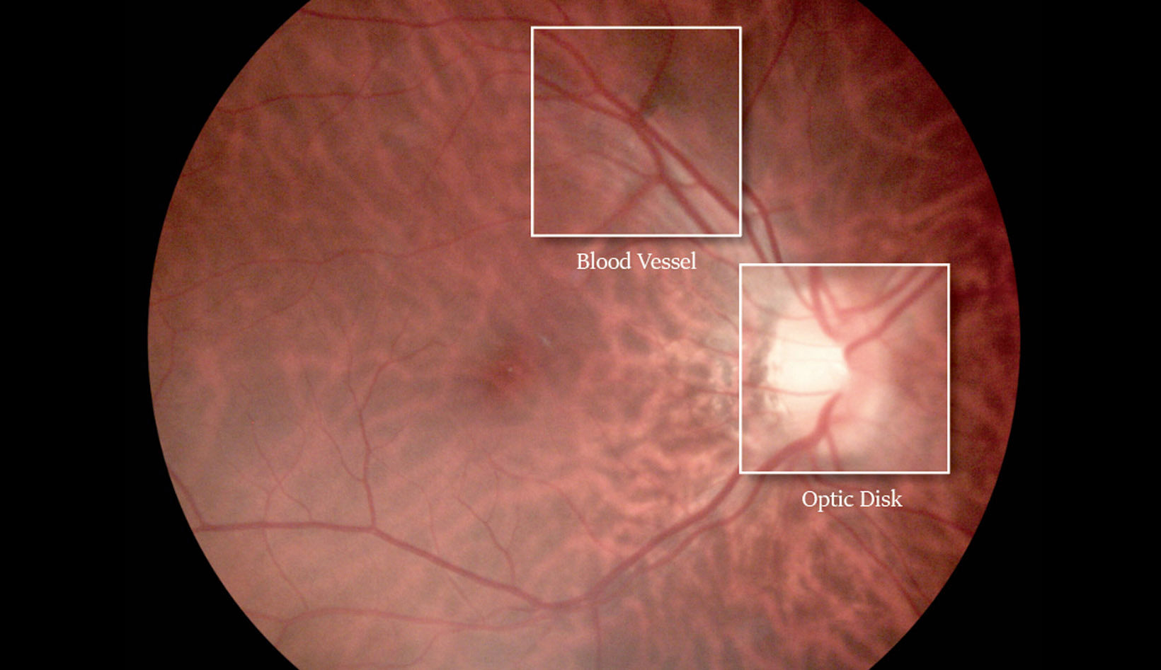 fundus camera efc-1800