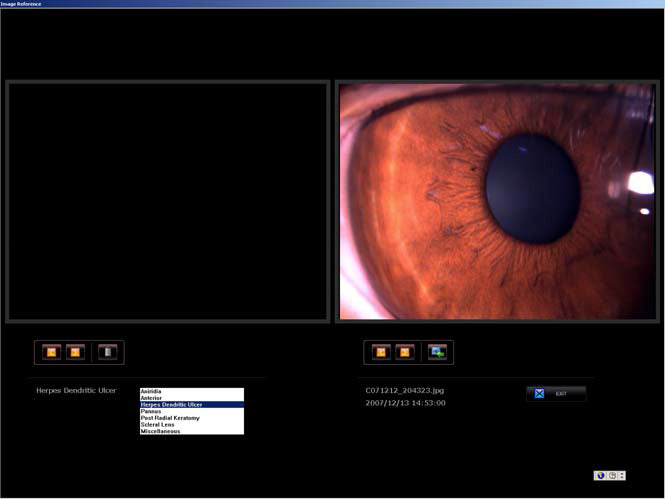 slit lamp his-7000