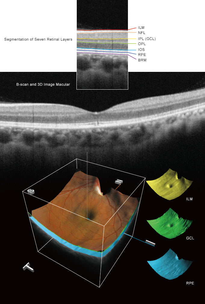 optical coherence tomography hoct-1 huvitz - us ophthalmic