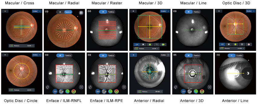 optical coherence tomography hoct-1 huvitz - us ophthalmic