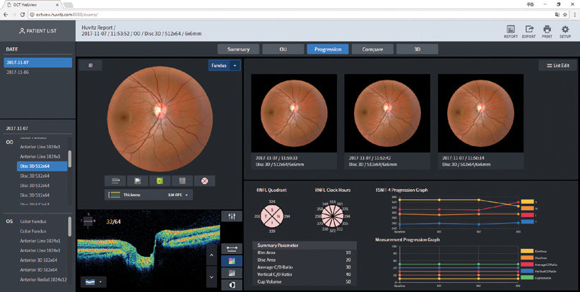 optical coherence tomography hoct-1 huvitz - us ophthalmic