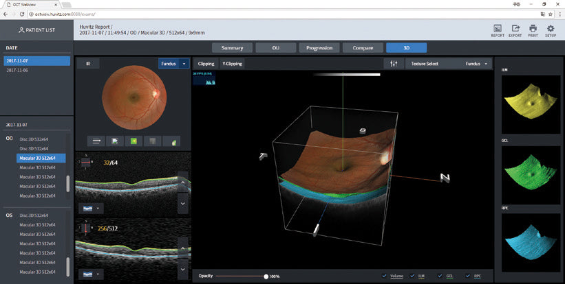 optical coherence tomography hoct-1 huvitz - us ophthalmic