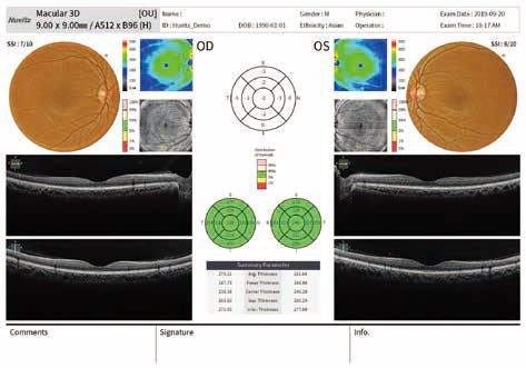 optical coherence tomography hoct-1 huvitz - us ophthalmic