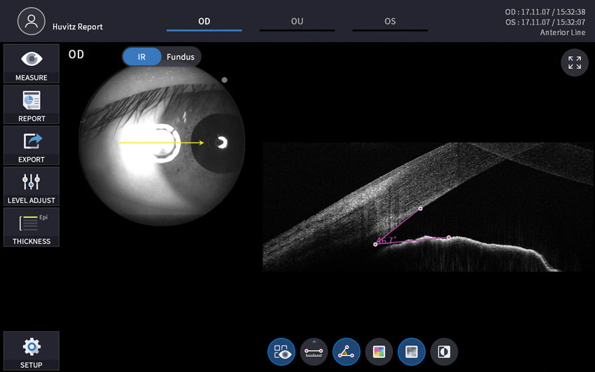 optical coherence tomography hoct-1 huvitz - us ophthalmic