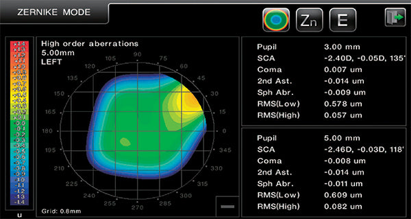 autorefractor keratometer hrk-8000a huvitz - us ophthalmic