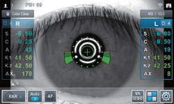 autorefractor keratometer hrk-9000 huvitz - us ophthalmic