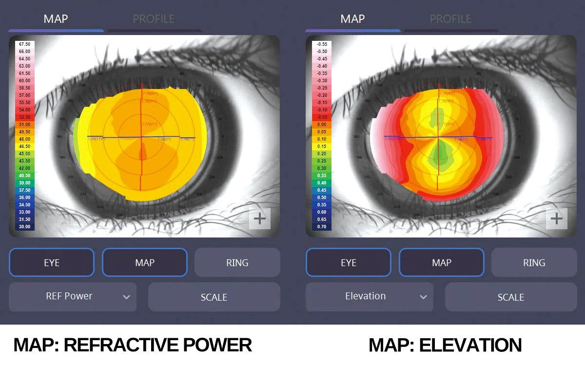 topographer htg-1