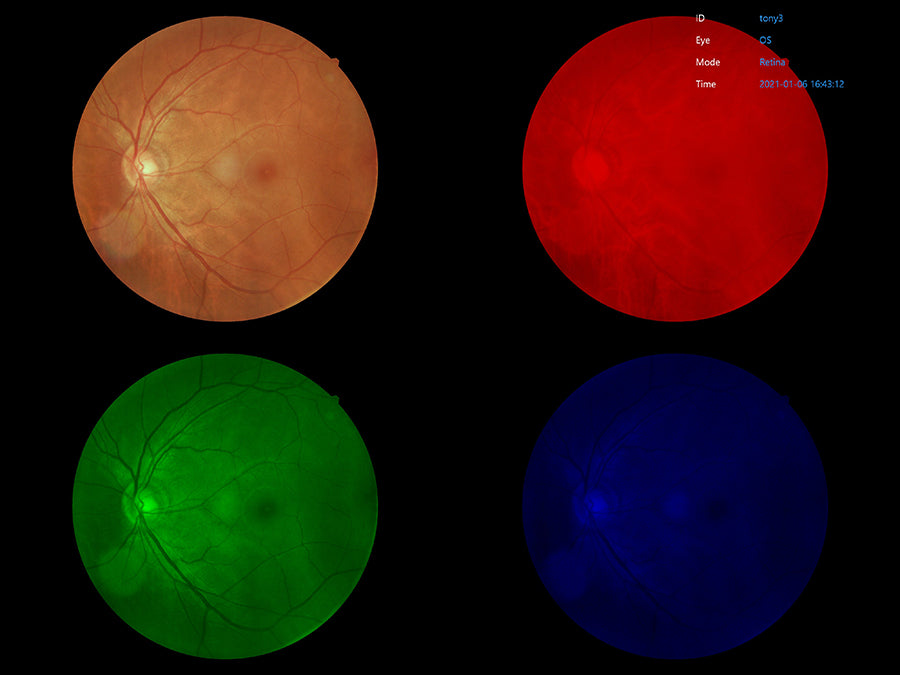 retinal camera efc2600 ezer - us ophthalmic