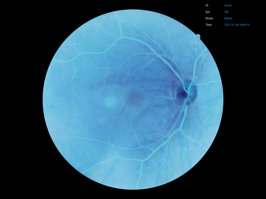 cámara retinal efc2600 ezer - us oftálmica