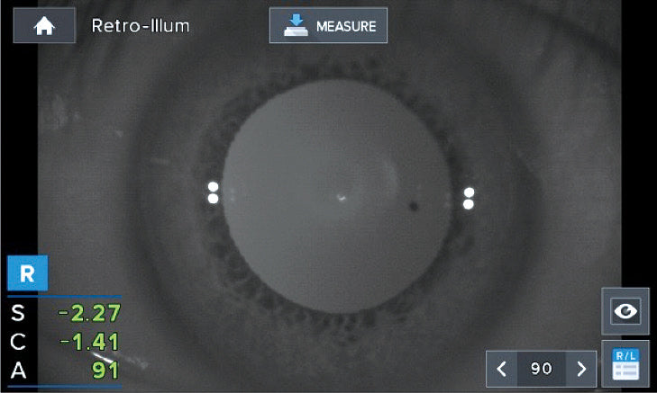 autorefractor keratometer hrk-1 huvitz - us ophthalmic