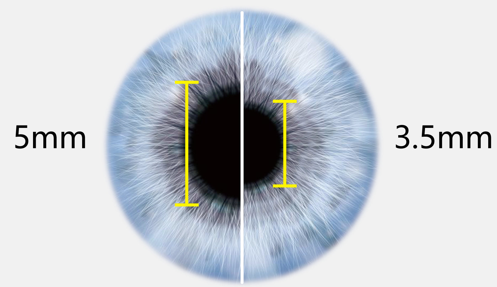 fundus camera efc-1800