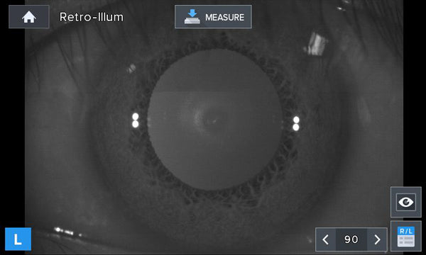 autorefractor keratometer LRK-7800 Luxvision - US Ophthalmic