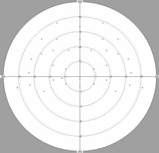 perimeter huvitz hvf-100