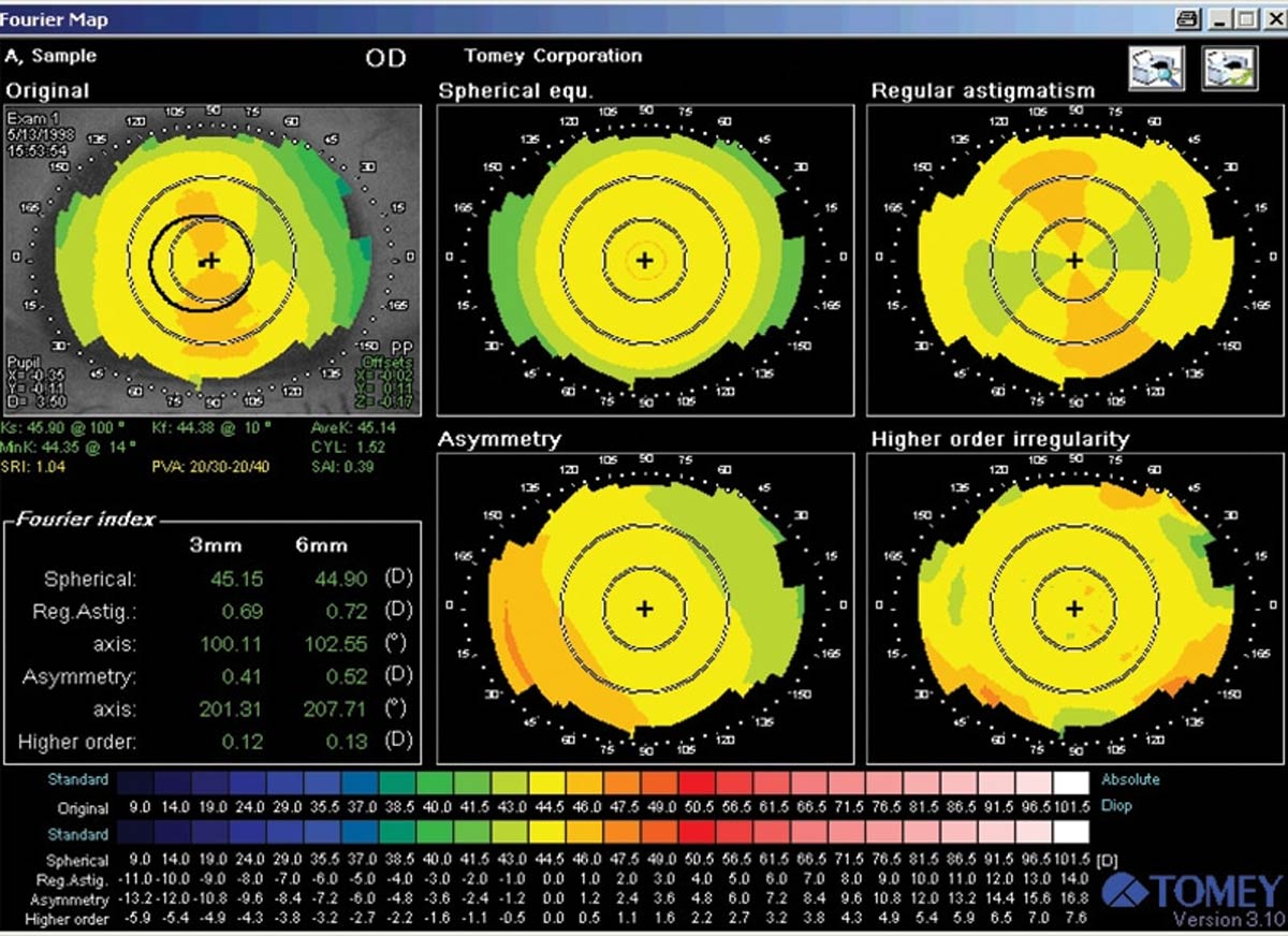 topógrafo corneal Tomey - US Ophthalmic