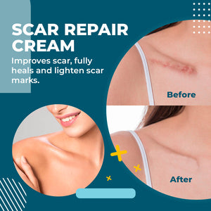 Natural Herb Scar Repair Cream