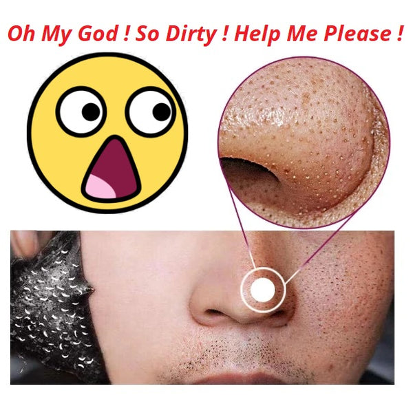 A picture of a man using a Smart Blackhead Remover on his dirty nose.
