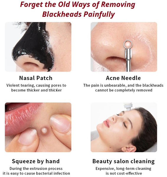 The painful and outdated method of removing blackheads is now simplified with a smart blackhead remover.