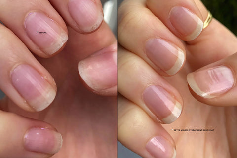 Miracle Treatment Base Coat before and after use