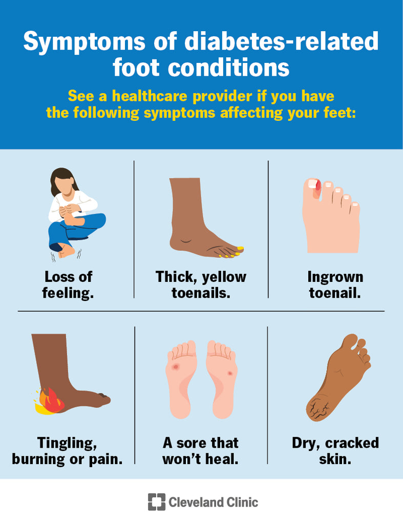 Cleveland Clinic: Foot Problems Diabetes