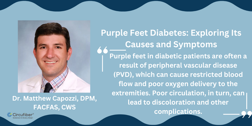 purple feet diabetes