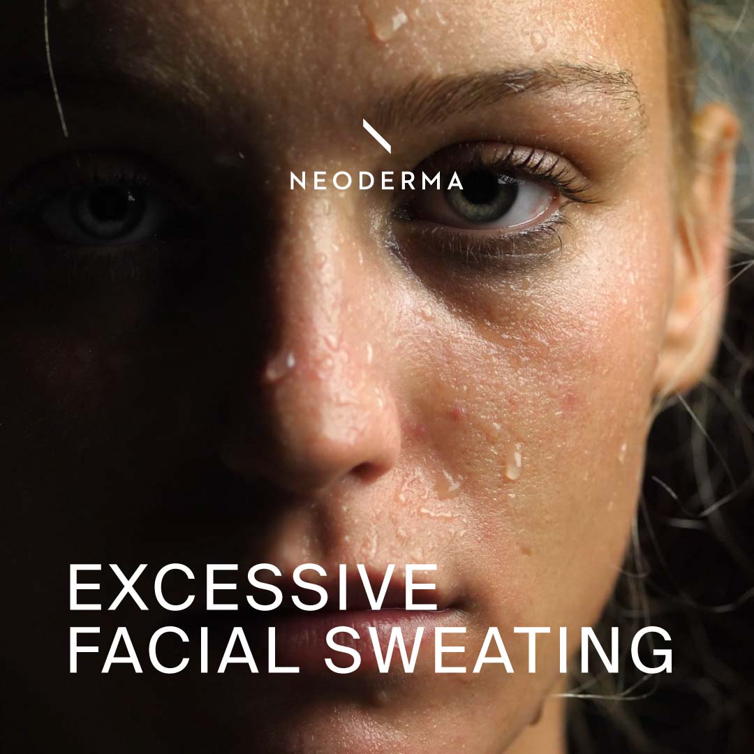 Excessive Facial Sweating Neoderma