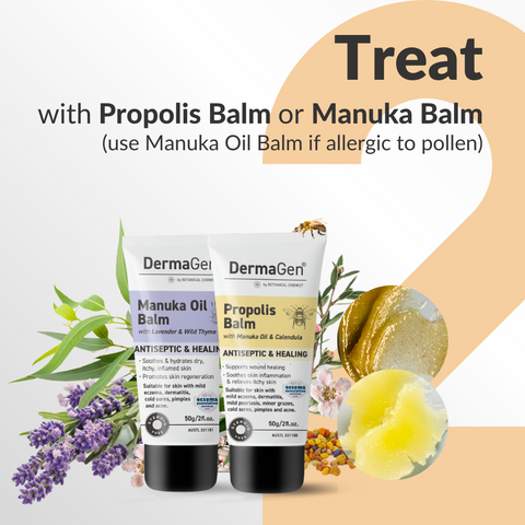 treat wound with propolis and manuka balms
