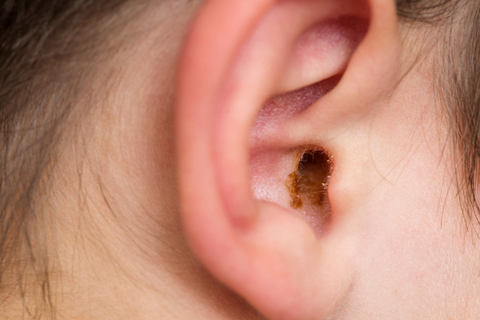 Everything Parents Need to Know About Earwax