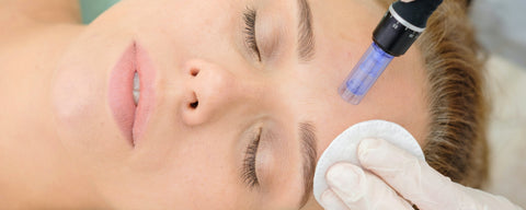 mrshighbrow-blogpost-needling