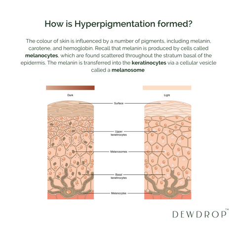Hyperpigmentation – Dewdrop Skincare