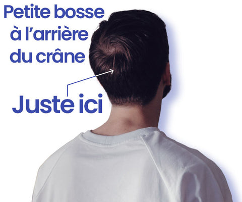 Homme brun de dos en t-shirt blanc avec flèche sur l'arrière de sa tête et marqué petite bosse à l'arrière du crâne