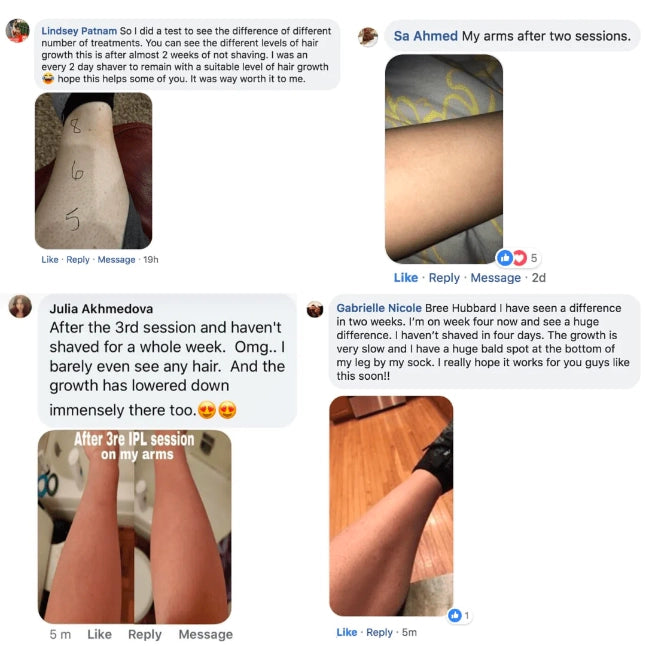 Reviews of our snowyskin laser hair removal product