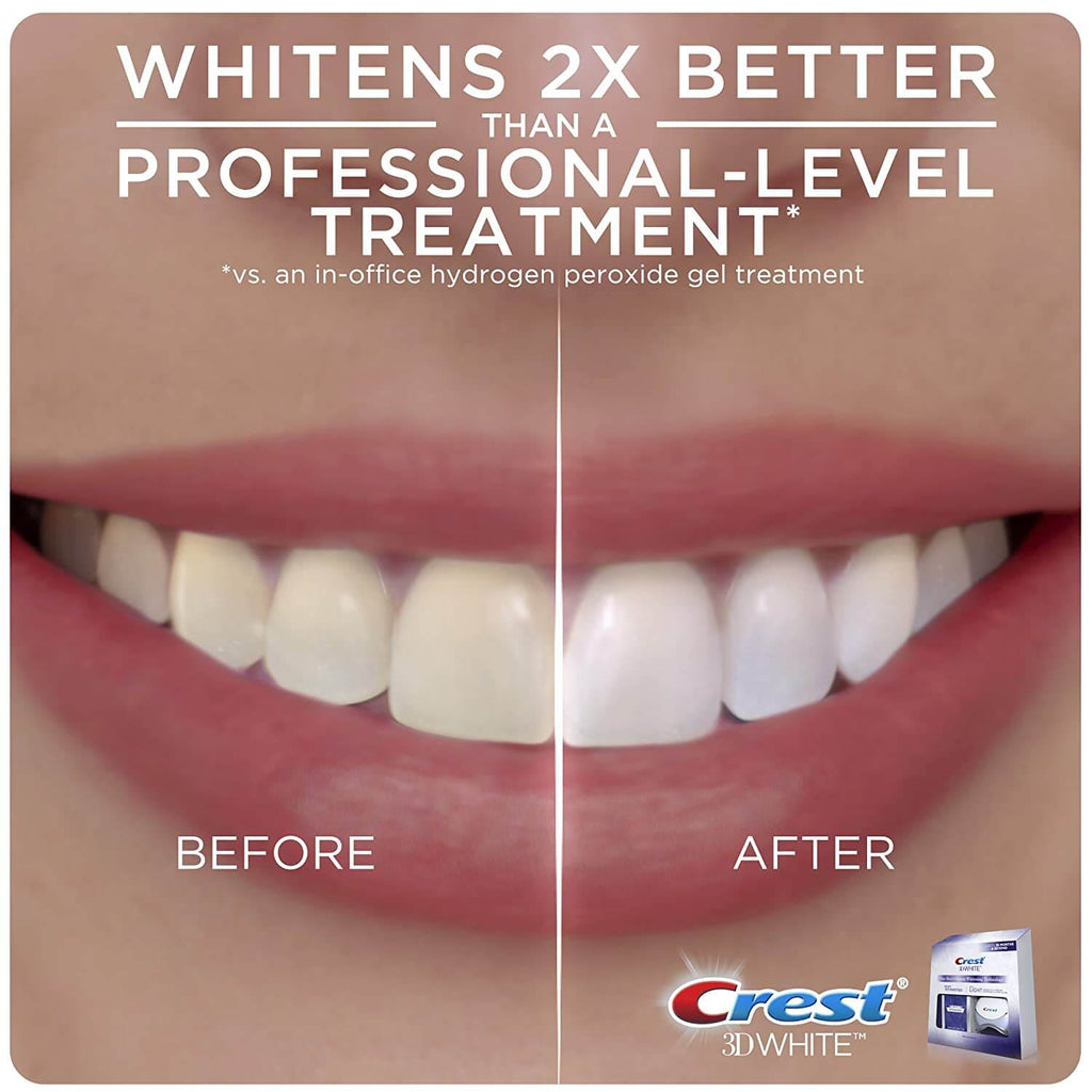 crest white strips work