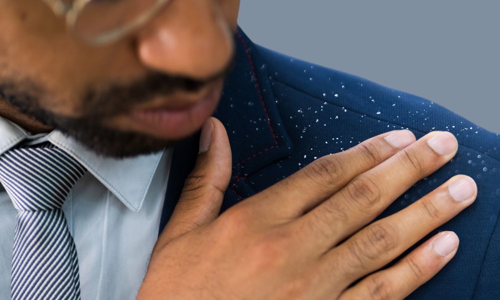 dandruff on shoulders, dandruff may affect other body parts other than the scalp