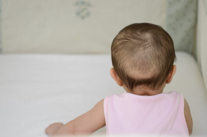 Baby Hair Loss Why Is My Infants Hair Falling Out