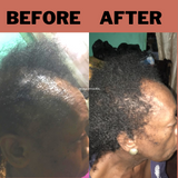 vigorroots root22serum repair baldness and hair loss