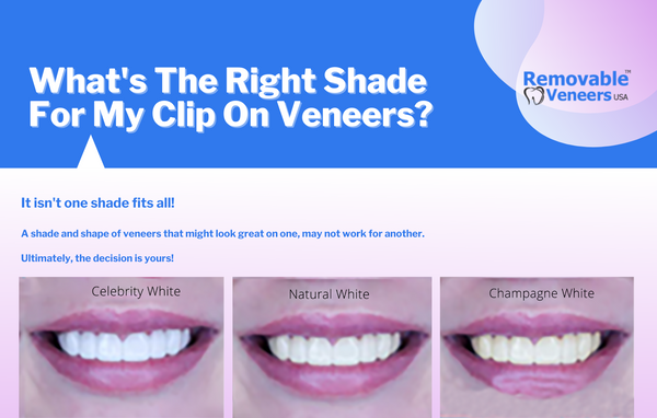 What's the right shade for my clip on veneers?