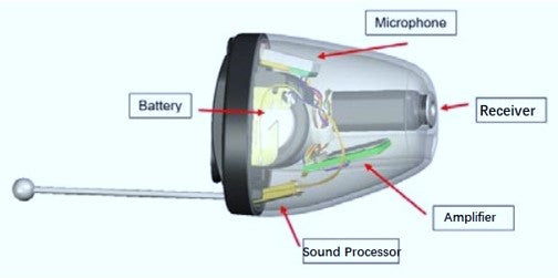 Structure of a CIC hearing aid