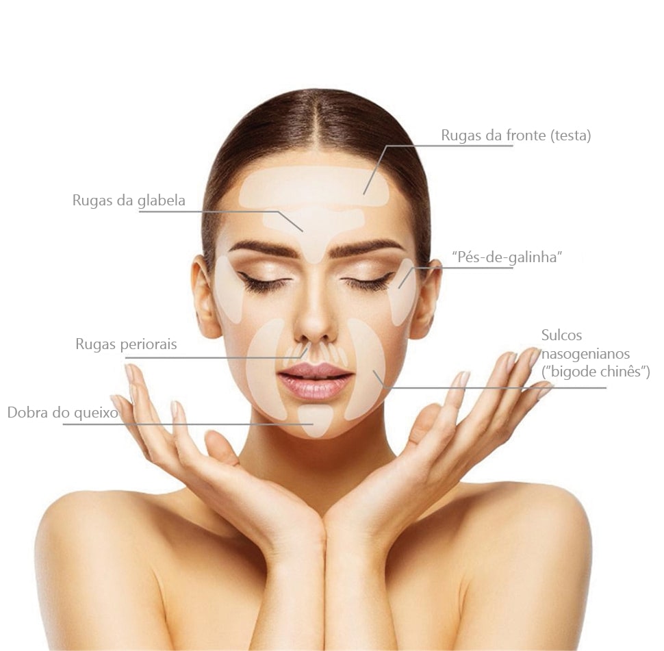 Tipos de rugas do rosto que o adesivo de silicone anti rugas ajuda a tratar/prevenir