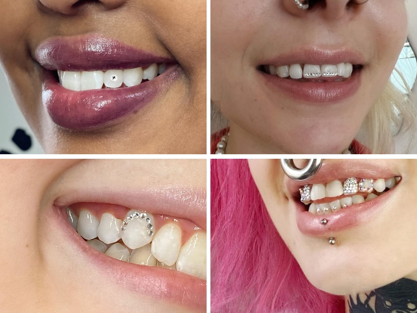 Tooth gems are back on trend and here to stay