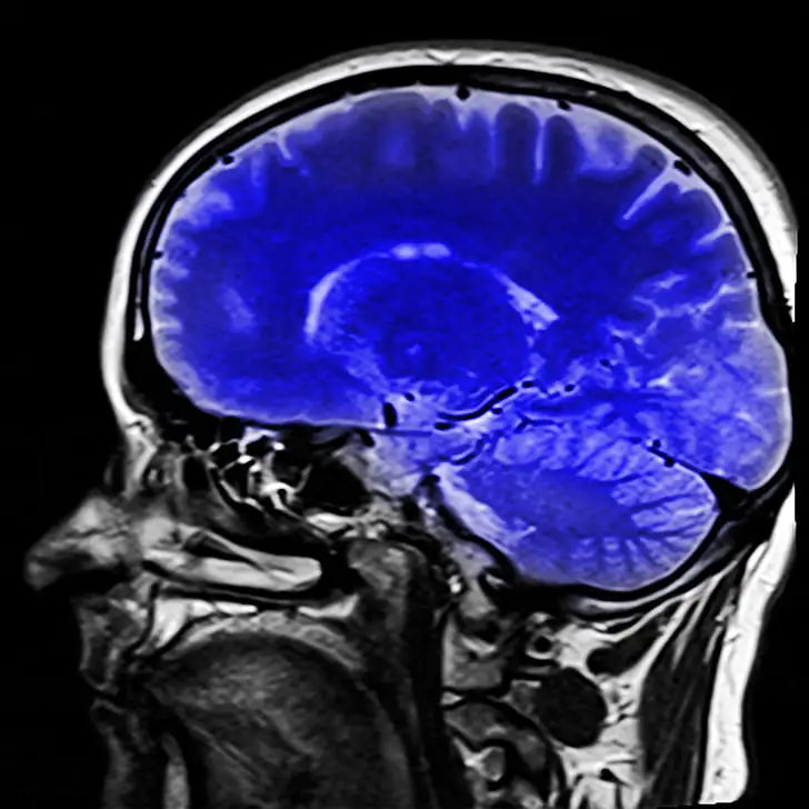 precision imaging - ct scan of the human brain