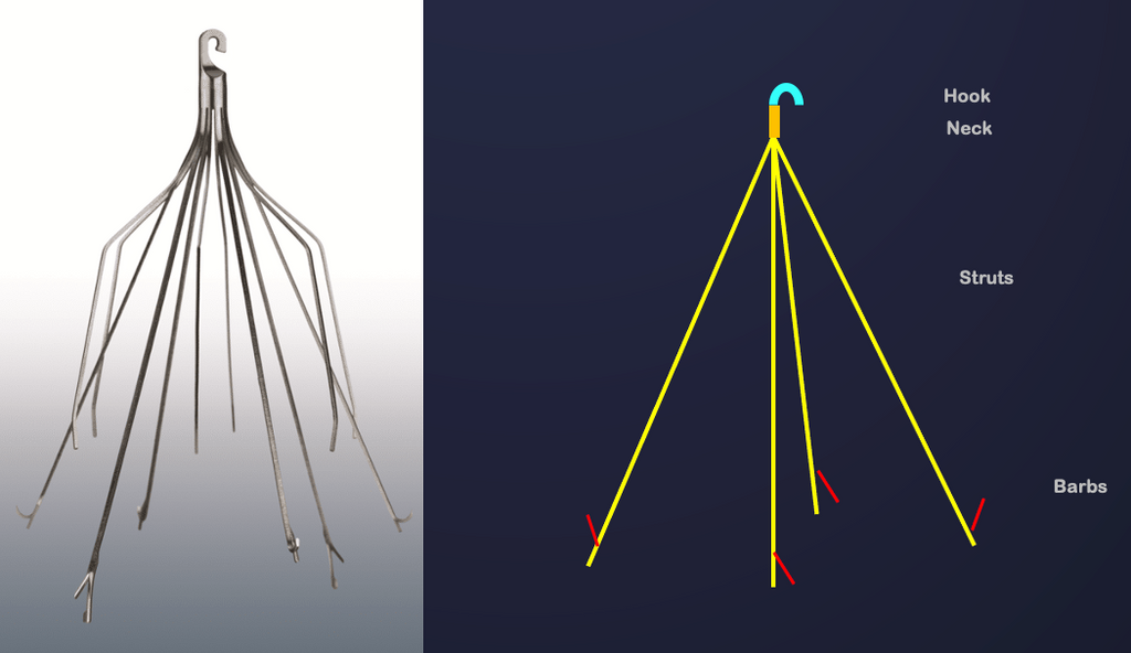 diagram of an ivc filter