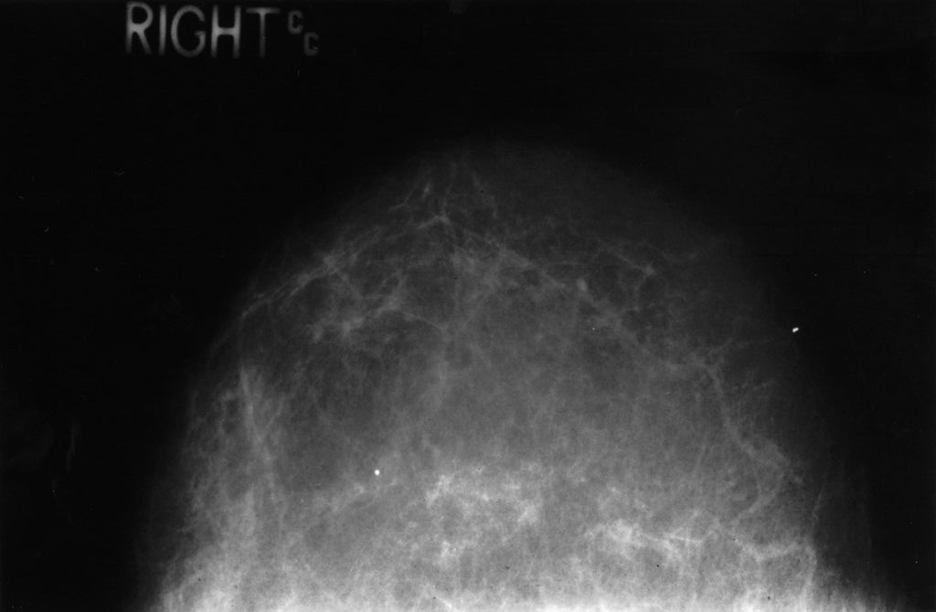 film mammogram showing a healthy fatty breast