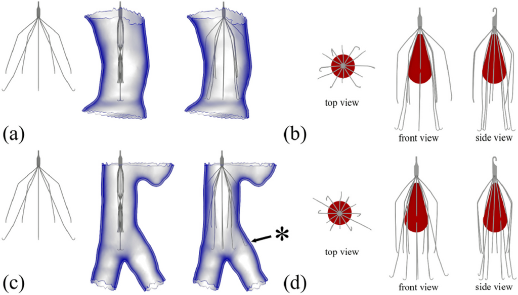 diagram of ivc filter placement