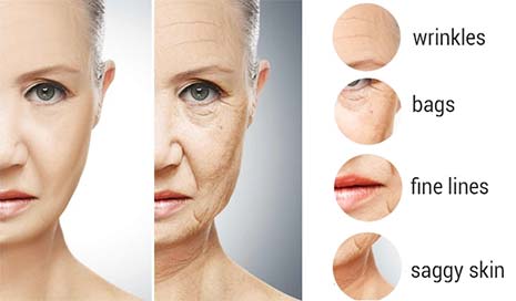 Signs of Aging Skin