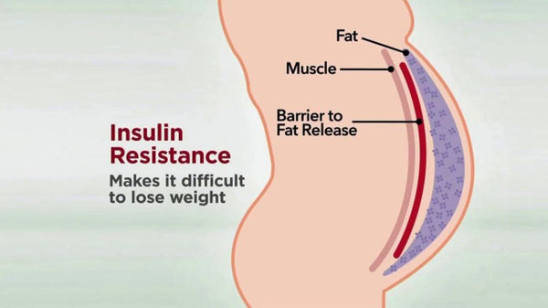 Insulin Resistance
