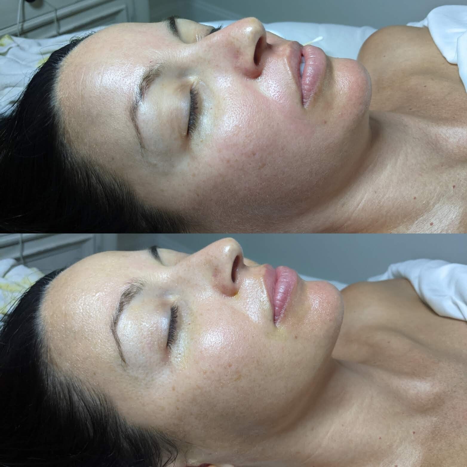 heat diffusion, facial sculpting, and vast-normative regulation following a Qi beauty treatment with Elizabeth